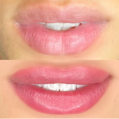 Imagem da área do serviço Micropigmentação Labial