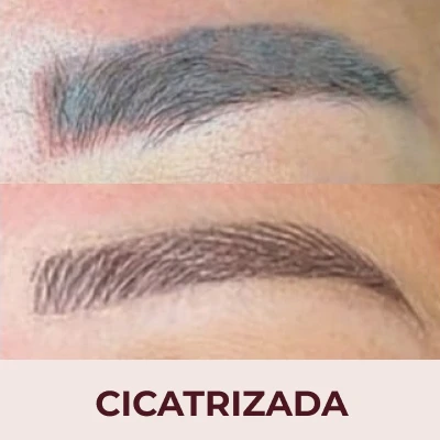 Imagem da área do serviço Correção personalizada