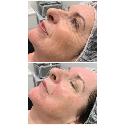 Imagem da área do serviço Rejuvenescimento Full Face